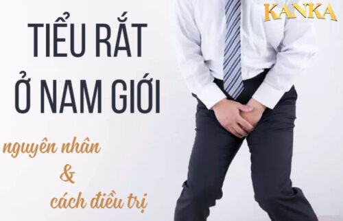 Tiểu rắt ở nam giới là hiện tượng nam giới rất buồn tiểu nhưng khi đi tiểu chỉ rặn được rất ít