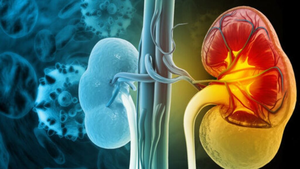 Bệnh suy thận mạn