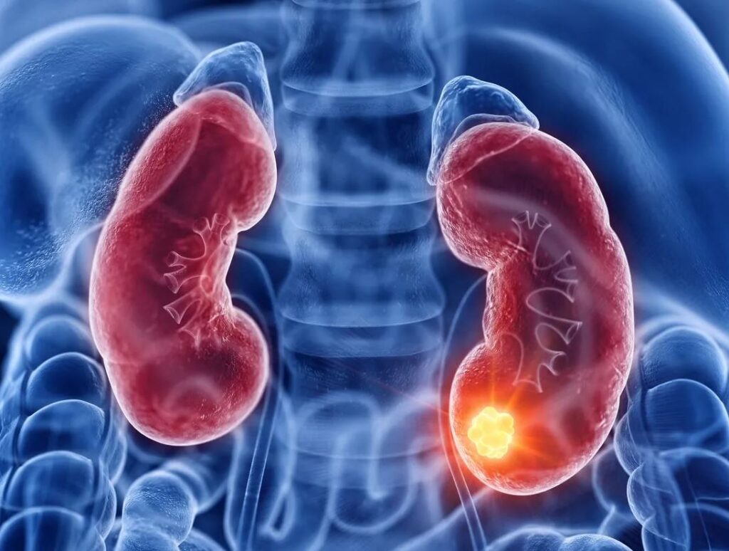 Thận yếu nam giới